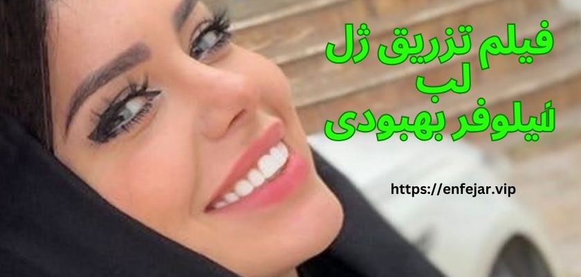 فیلم تزریق ژل لب نیلوفر بهبودی