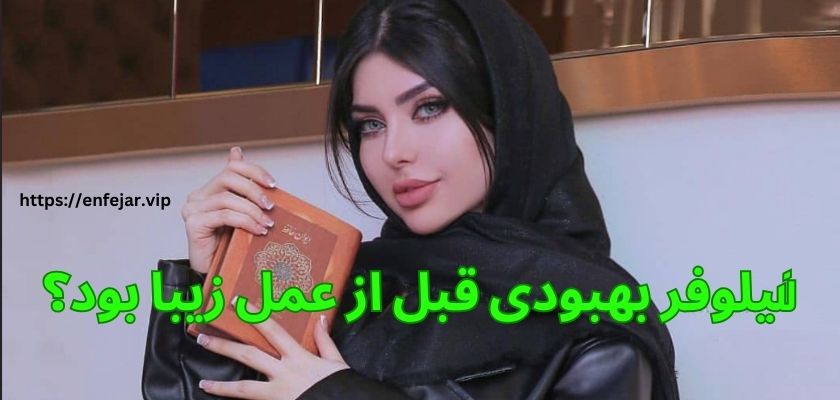نیلوفر بهبودی قبل از عمل زیبا بود؟